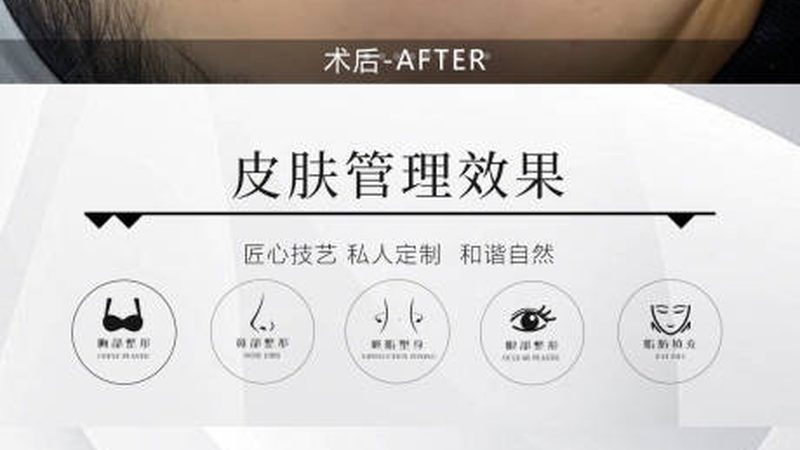 水光针和玻尿酸，到底是不是一回事