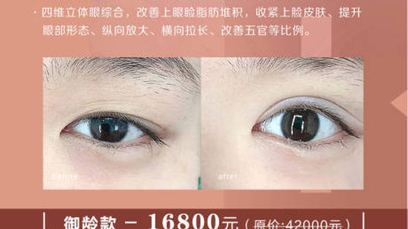 激光祛斑后黄褐斑复发怎么预防