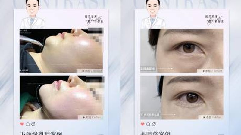 北京瘦脸针，揭秘价格背后的真相