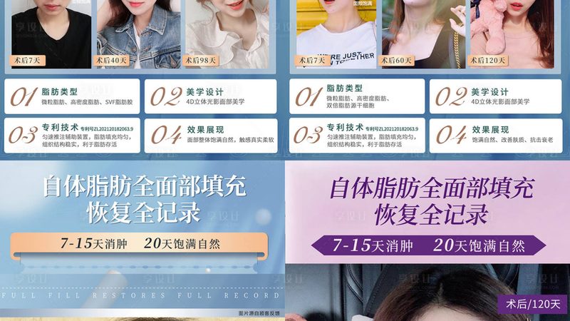 市面上玻尿酸品牌众多，如何选择合适的品牌呢？以下是一些关键点：