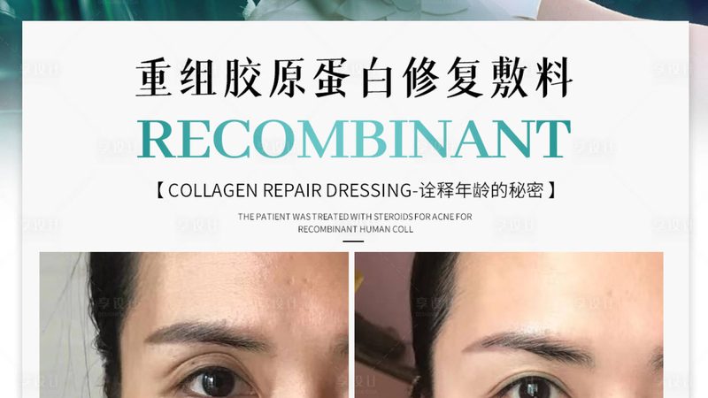 医用玻尿酸定制服务：揭秘个性化注射之美**