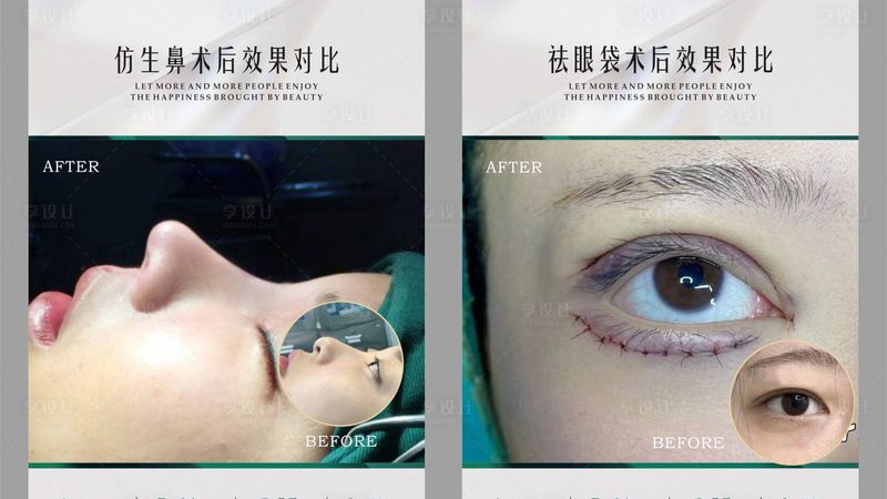 医美咨询师如何精准把握客户需求
