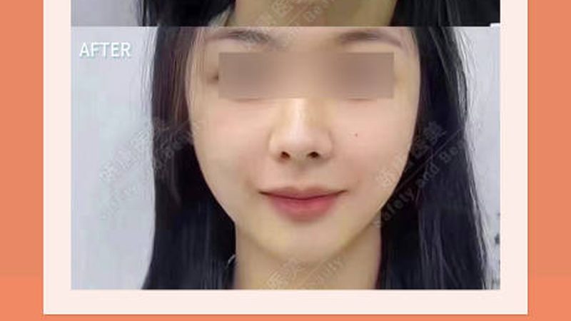 皮肤管理中心与美容院：揭秘两者差异，选择更明智