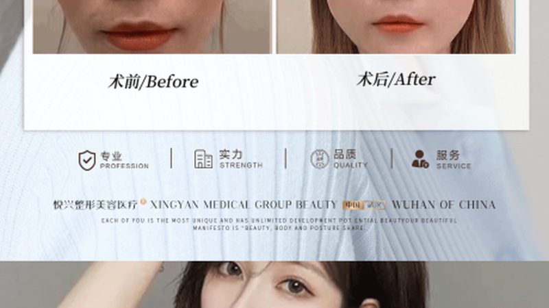轻医美与医美，价格差异背后的真相
