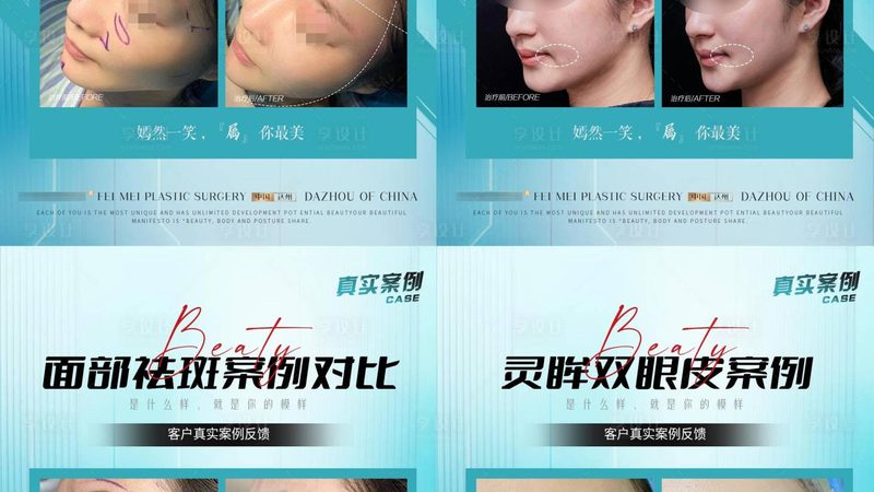 家用激光脱毛仪：揭秘排名前十的选购秘诀
