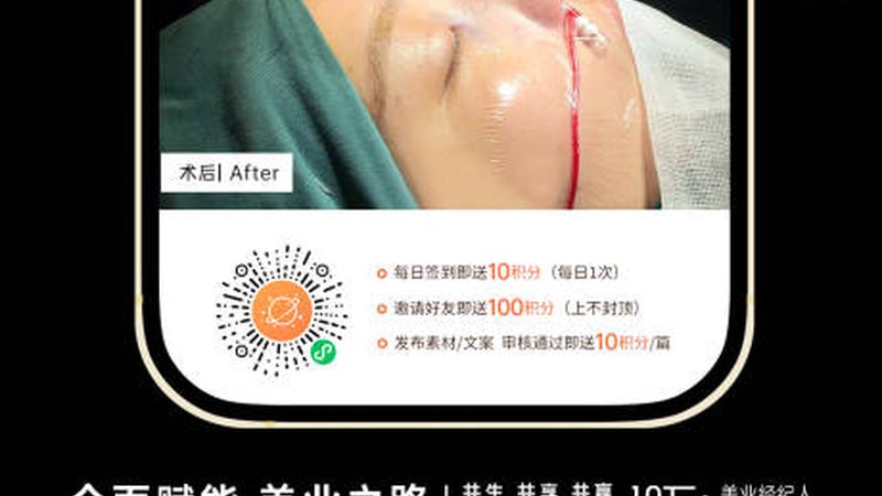 广州光子嫩肤团购哪个牌子仪器好