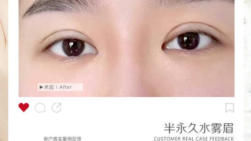 揭秘抗衰医美项目，价格一览背后的秘密