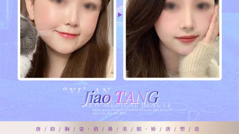成都激光脱毛前需要做什么准备