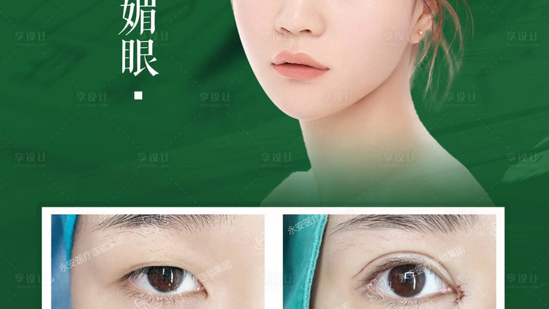 医用水光针：揭秘其原理与选购要点