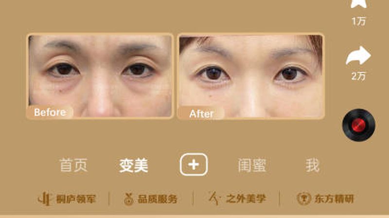 成都医美价格贵不贵有议价空间吗