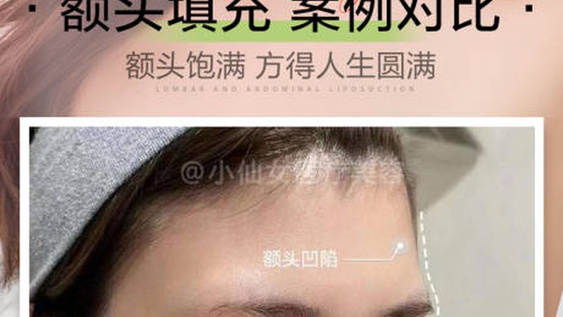 双眼皮贴不伤眼皮？揭秘十大品牌背后的秘密