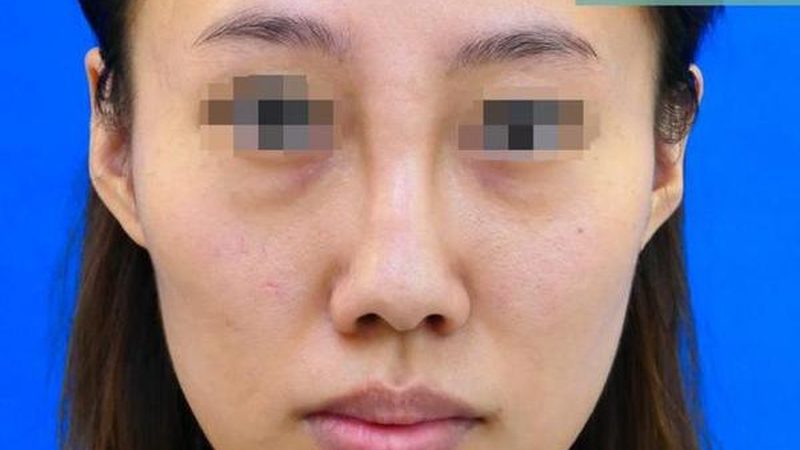 医美级抗衰护肤品，私人定制的秘密